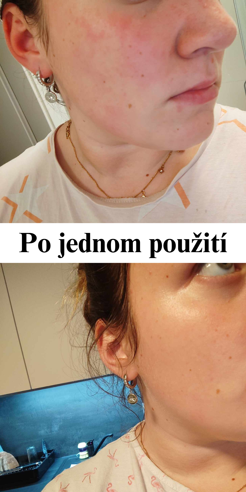 Účinky prírodnej kozmetiky Barbora Lori, pred a po, zmena už po 1 použití, kožné problémy
